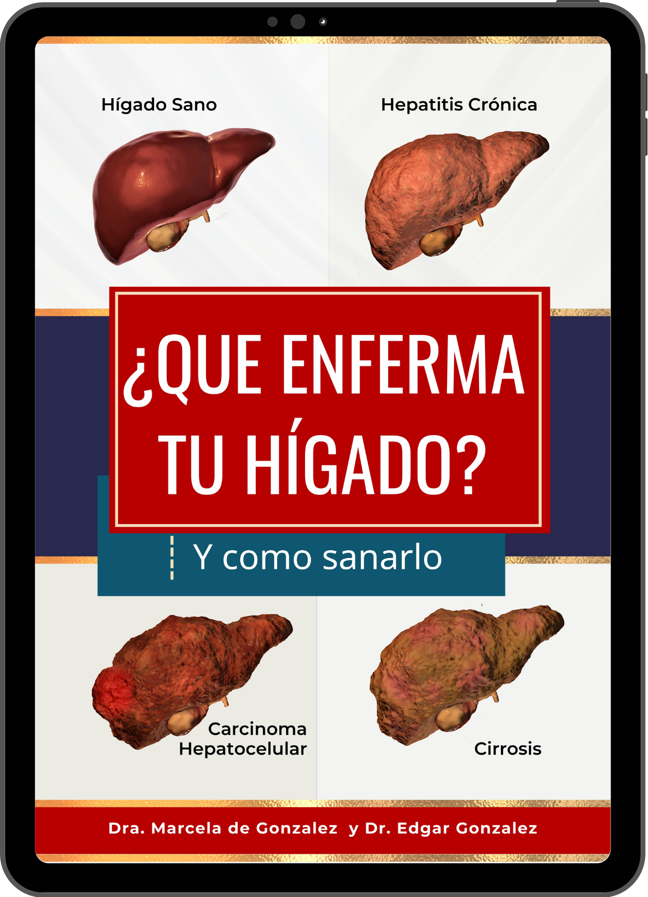 ¿QUE ENFERMA TU HÍGADO? ¿Y como sanarlo?